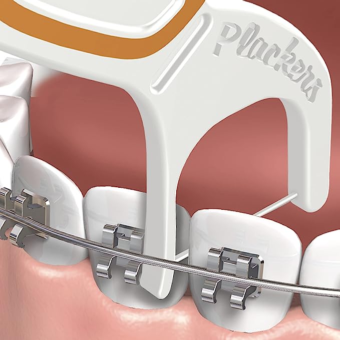 Plackers Orthopick Dental Floss Picks for Braces (36 counts/pack) NT Shop